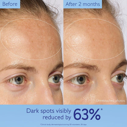 HOTCaudalie Vinoperfect Brightening Dark Spot Serum Vitamin C Alternative