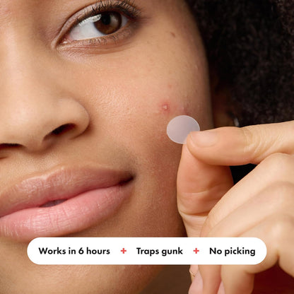HOTHero Cosmetics Mighty Patch Original Nighttime Acne Pimple Patches, 75 Ct | #1 Hydrocolloid Acne Patches, Shrinks Zits & Whiteheads in 1 Use, Spot Treatment Pimple Stickers for Face