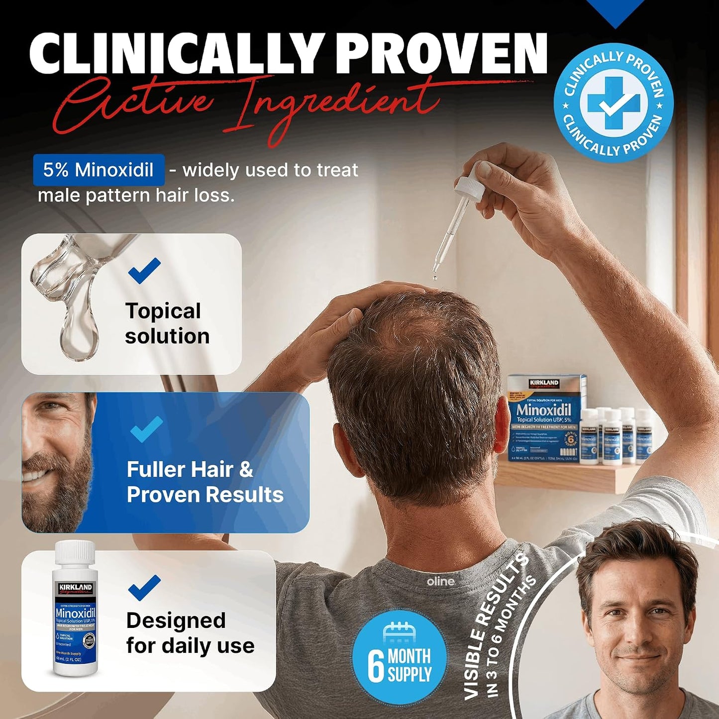 HOTMinoxidil Liquid Extra Strength Hair Regrowth Treatment for Men, 5% Topical Solution, 6 Months Supply - Dropper Applicator and Bonus Free Instructional Guide Included