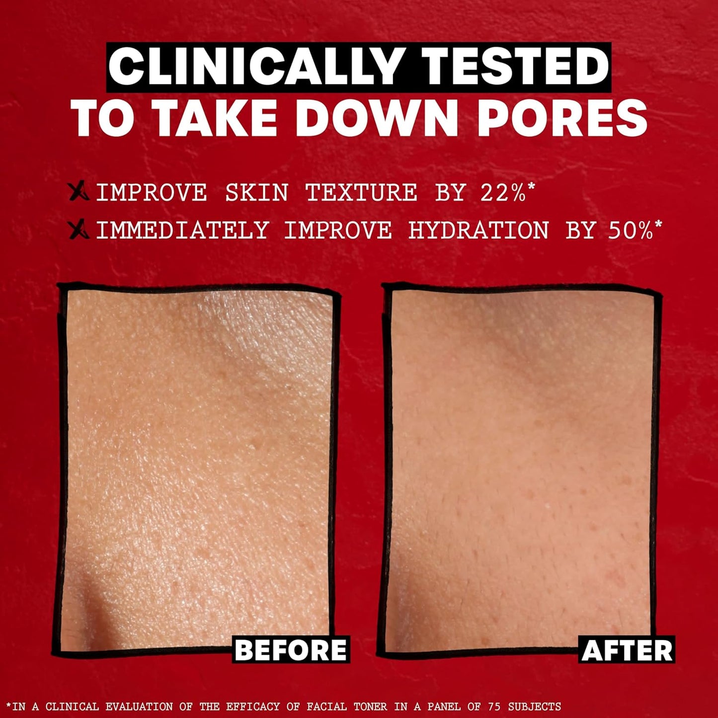 HOTTHAYERS Alcohol-Free, Hydrating, Unscented Witch Hazel Facial Toner with Aloe Vera Formula, Vegan, Dermatologist Tested and Recommended, 12 Oz (Packaging May Vary)