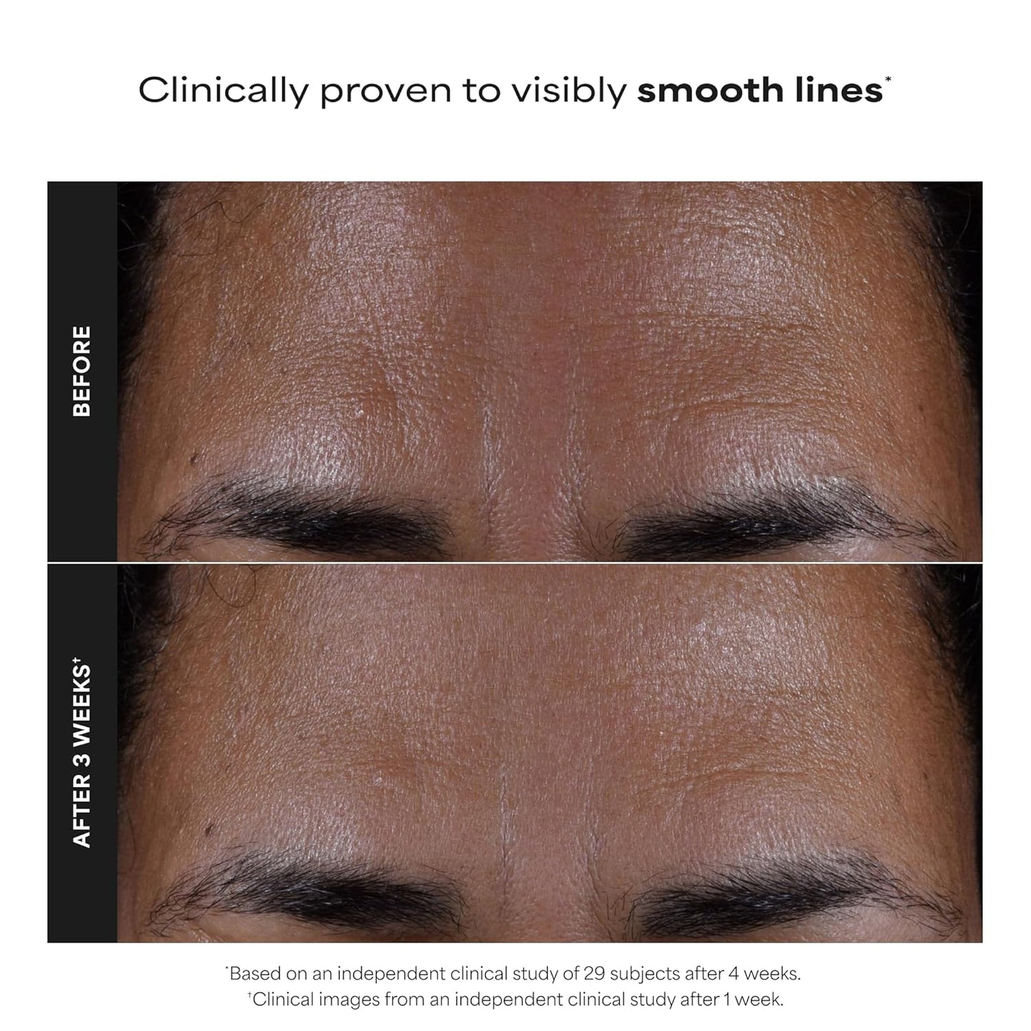 HOTPaula's Choice SKIN PERFECTING 2% BHA Liquid Exfoliant with Salicylic Acid, Facial Polish for Pores, Wrinkles & Fine Lines, Suitable for Blackhead-Prone Skin, Fragrance-Free