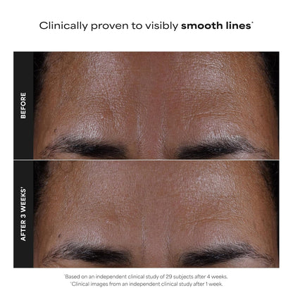 HOTPaula's Choice SKIN PERFECTING 2% BHA Liquid Exfoliant with Salicylic Acid, Facial Polish for Pores, Wrinkles & Fine Lines, Suitable for Blackhead-Prone Skin, Fragrance-Free