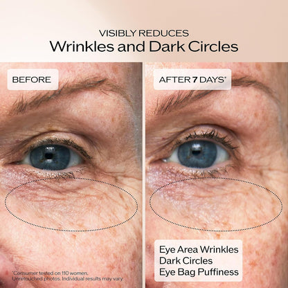HOTShiseido Benefiance Wrinkle Smoothing Eye Cream - 15 mL - Visibly Improves Five Types of Eye Wrinkles, Dark Circles & Puffiness - 48-HR Hydration - All Skin Types - Non-Comedogenic