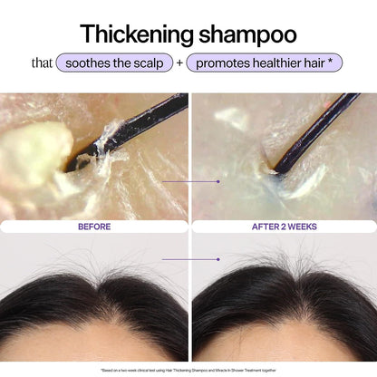 HOTDr. Groot Hair Thickening Shampoo, Korean Hair Care with Biotin, Rosemary Oil to Help Volumize Thinning, Damaged Hair, Hydrate Hair and Scalp, Biotin Shampoo, Scalp Revitalizing Solution