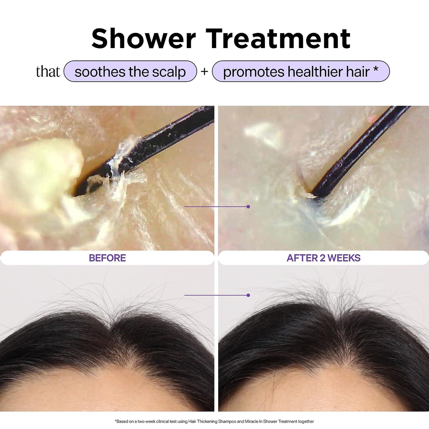 HOTDr. Groot Miracle in Shower Moisturizing Treatment for Hair Loss, Korean Hair Care Rinse, Rosemary Oil for Smooth, Healthier-Looking Hair in 5 Seconds, Scalp Revitalizing Solution