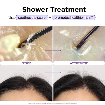 HOTDr. Groot Miracle in Shower Moisturizing Treatment for Hair Loss, Korean Hair Care Rinse, Rosemary Oil for Smooth, Healthier-Looking Hair in 5 Seconds, Scalp Revitalizing Solution