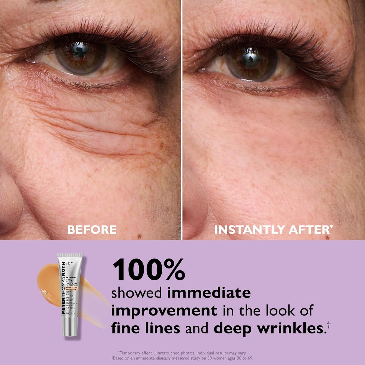HOTPeter Thomas Roth | Instant FIRMx® Eye Temporary Eye Tightener Easy-Wear Formula | For Firming Under-Eye Bags & Wrinkles