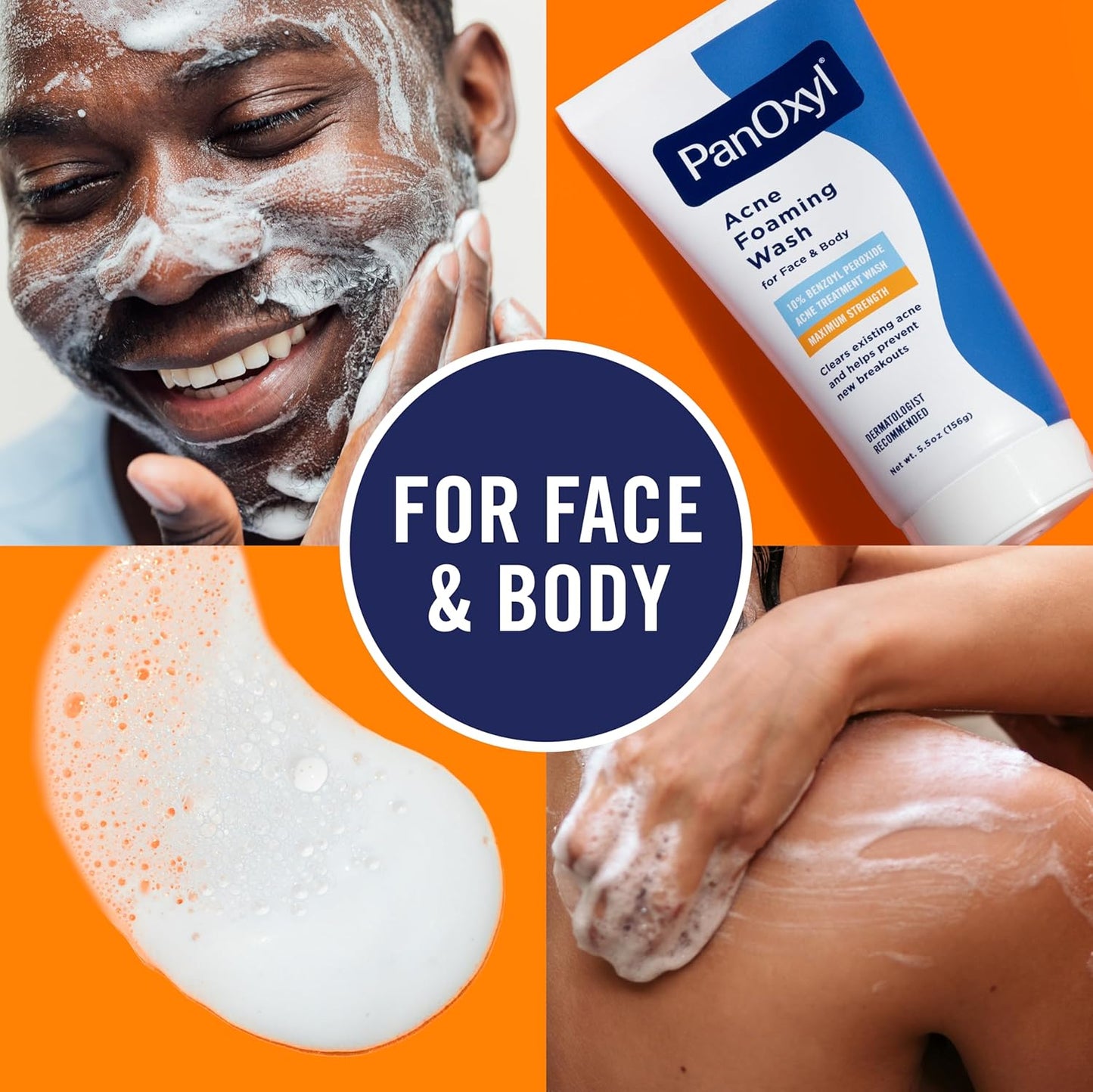 HOTPanOxyl 10% Benzoyl Peroxide Acne Foaming Wash, Maximum Strength, Daily Acne-Fighting Face and Body Cleanser, Face Wash to Clear, Treat and Prevent Acne Pimples and Stubborn Breakouts, 5.5 Oz Tube
