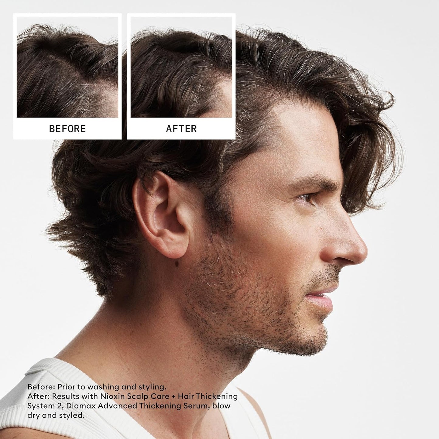 HOTNIOXIN System 2 | Scalp Care | Shampoo | Hair Thickening | For Natural Hair | Scalp Health | For Natural Hair with Progressed Thinning | Cleanse & Boost Hair Density with Niacinamide & Biotin