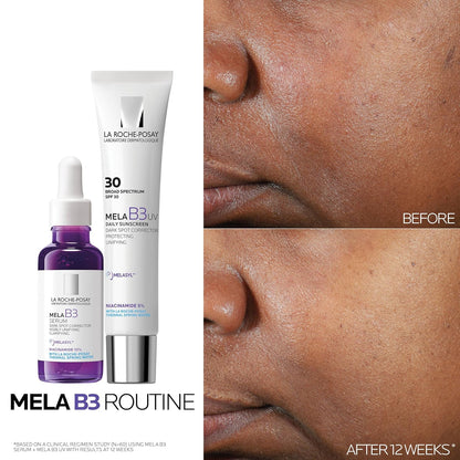HOTLa Roche-Posay Mela B3 Dark Spot Face Serum with 10% Niacinamide, 1oz | Anti-aging dark spot correcting face serum with Melasyl™ for sun spots, age spots, and post-acne marks. Lightweight texture.