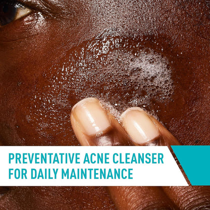 HOTCeraVe Acne Treatment Face Wash, Salicylic Acid Cleanser with Purifying Clay, Niacinamide, and Ceramides, Pore Control and Blackhead Remover, 8 Ounce